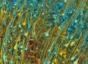 「一立方毫米」大脑，壮观细节图